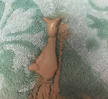 <p>When calcium builds up in bladder</p><p>Can lead to cystitis, uroliths, incontinence etc</p><p>Common signs - <span>dysuria/pollakiuria, painful urination, PUPD, incontinence, urine scalding, haematuria, abnormal urine</span></p><p>Treatment - analgesia, antibiotics, manage urine scald, clean bedding, increase exercise, increase water intake, reduce calcium intake, catheterise and flush bladder</p>