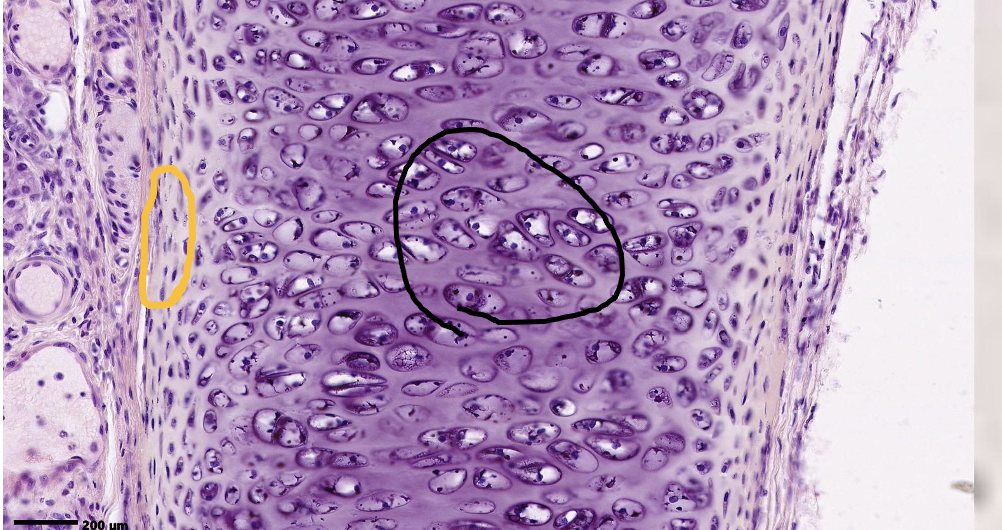 <p>What is the mechanism of tissue growth within the black circle? What is the mechanism of tissue growth within the orange circle?</p>