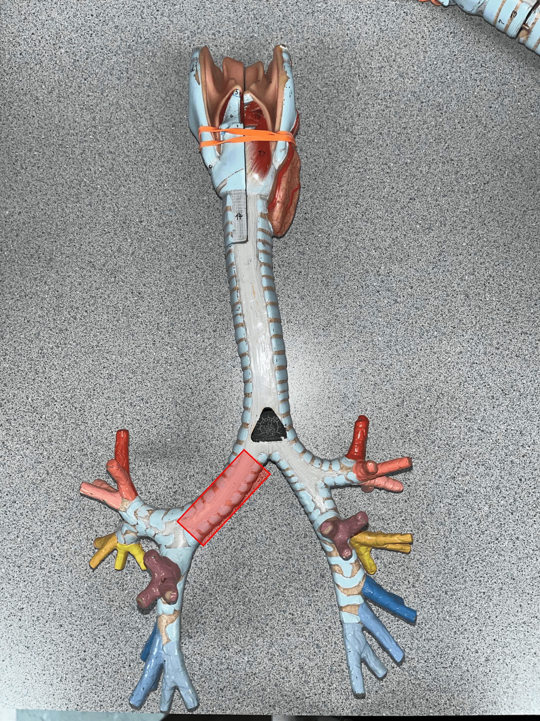 • The R. branch of the bronchial tree after the carina.

• Supplies the R. lung.

• Branches into three secondary bronchi.

• Also known as a main bronchus.