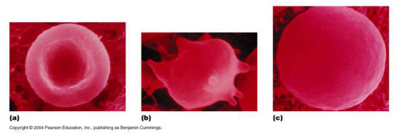 <p>Which red blood cell is under hypertonic conditions?</p>