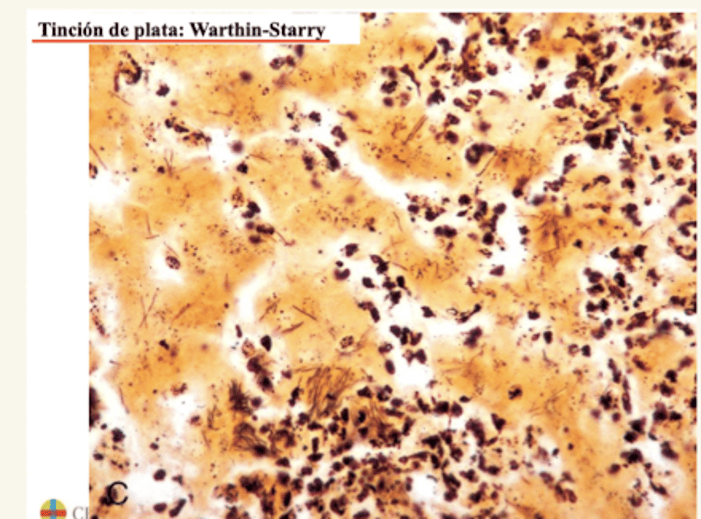 <p>hígado.</p><p>¿diagnóstico y etiología?</p>