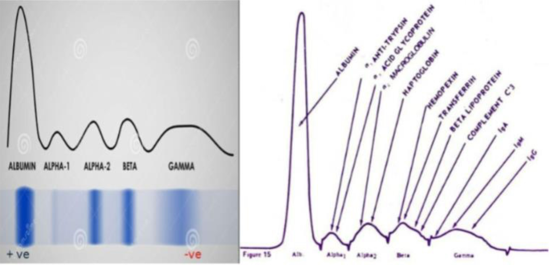 <p>From left to right: albumin, antitrypsin, haptoglobin, transferrin, LDL, c3, IgM</p>