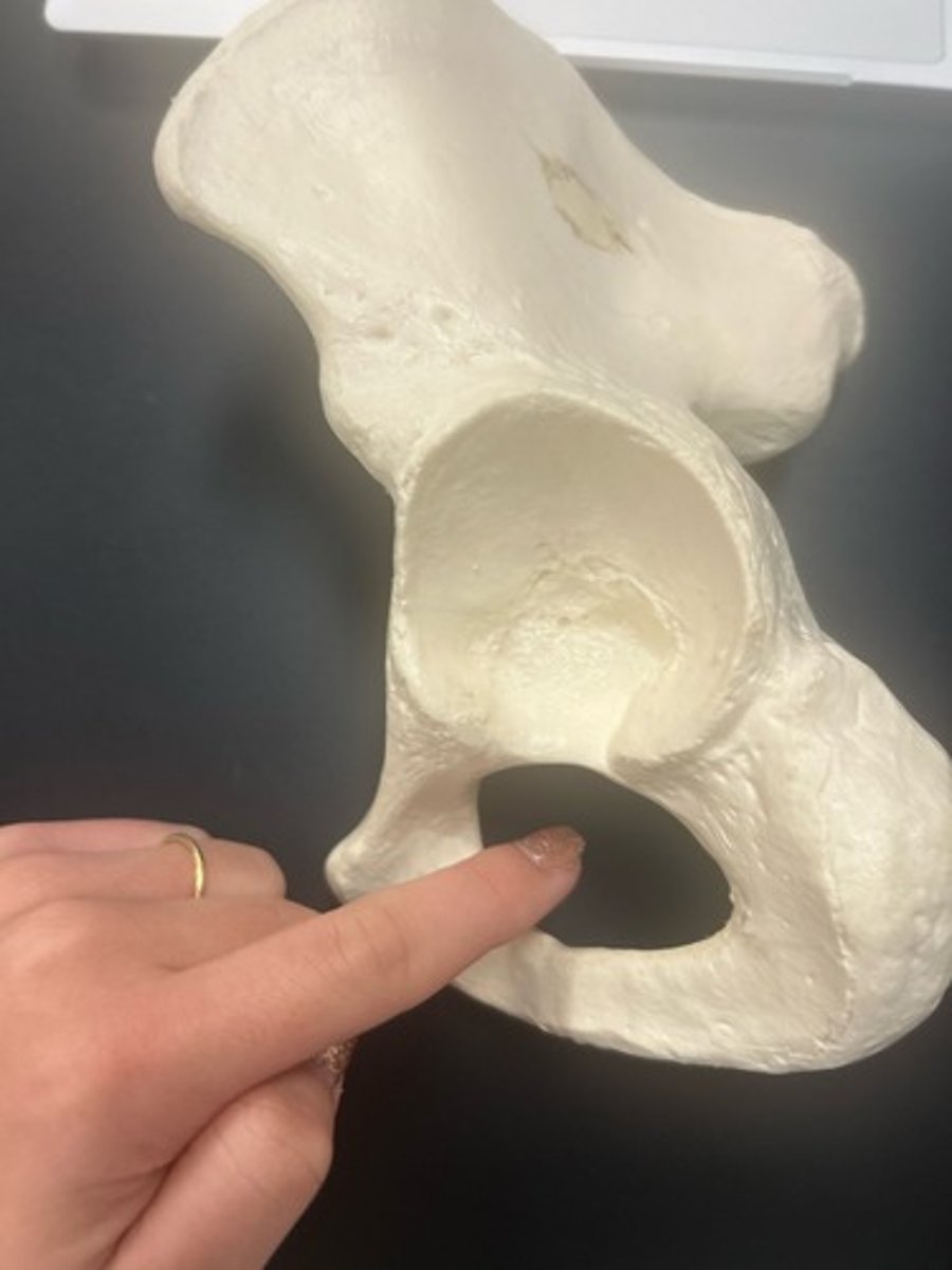 <p>name the bone</p>