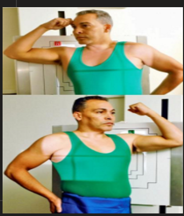 <p>CR / RP </p>