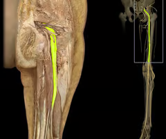 nerve running deep to the gluteus maximus; typically deep to the piriformis but sometimes superficial to it or piercing through it
