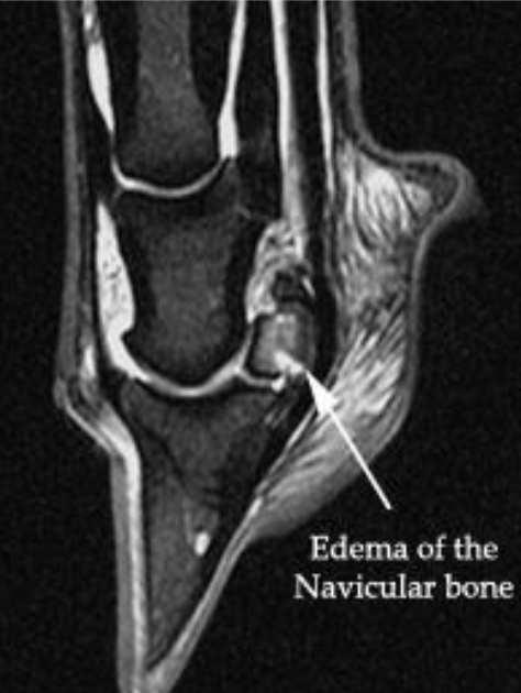 <p>what is arrow pointing at on MRI </p>