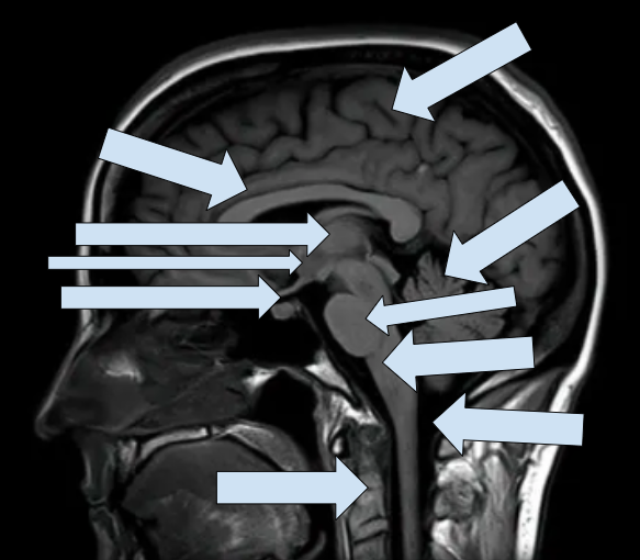 <p>Left to right</p>