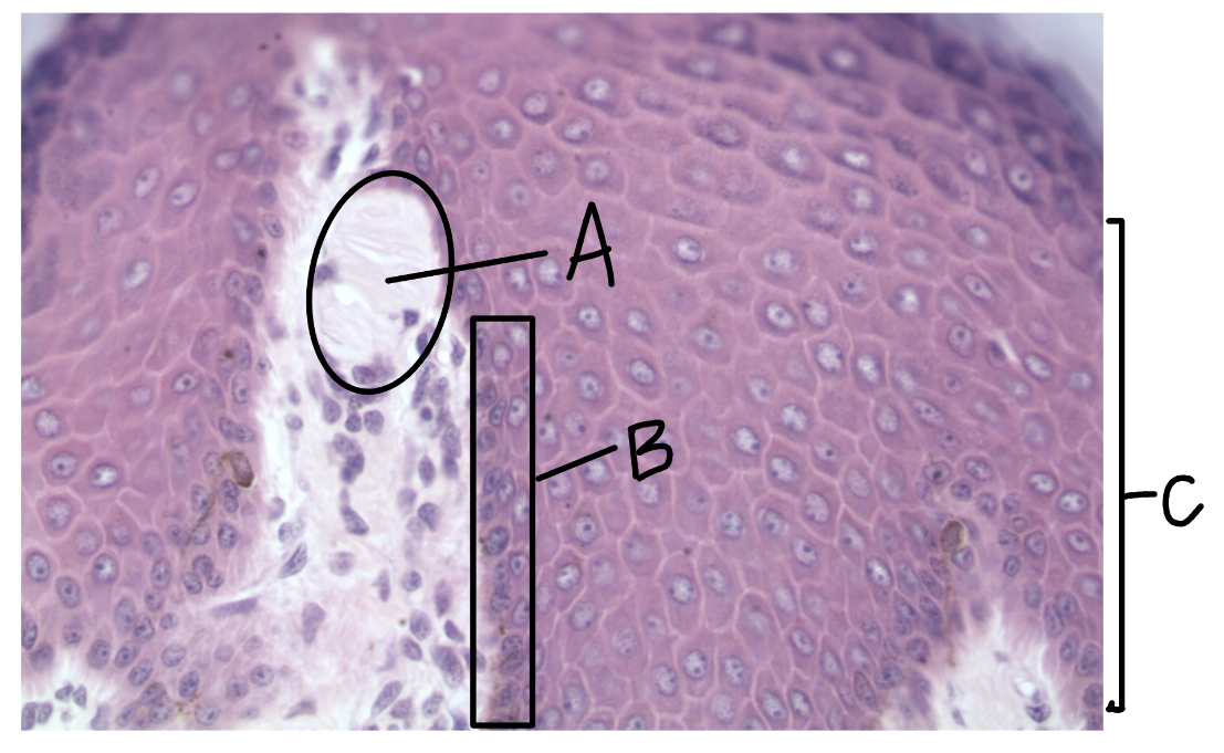 <p>What is this a picture of? Identify the highlighted structures and describe them.</p>