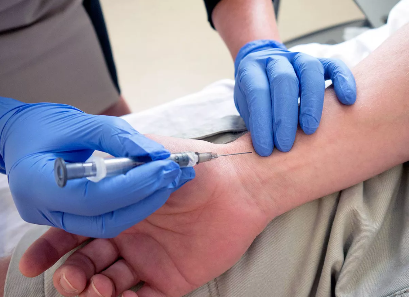 <ul><li><p>arterial blood specimen</p><ul><li><p>The preferred specimen</p></li><li><p>is usually taken from an artery from the inside of the wrist (radial artery)</p></li><li><p>see image</p></li></ul></li></ul><p></p><p></p><ul><li><p>venous blood specimen</p><ul><li><p>collected from the veins.</p></li></ul></li></ul><p></p><ul><li><p>capillary blood specimen</p><ul><li><p>collected by dermal puncture to</p><ul><li><p>heel (always heel for babies)</p></li><li><p>finger</p></li><li><p>toe</p></li></ul></li><li><p>a lancet is used to make an incision of smaller than 2.0 mm</p></li></ul></li></ul><p></p>