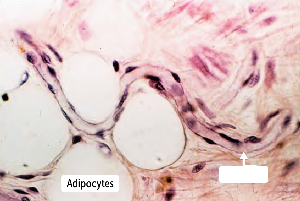 <p>__________ are only one cell layer thick (to increase diffusion capacity. They have only a tunica intima, histologically, they show only an endothelium and the associated basement membrane.</p>
