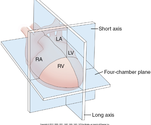 <p>What is the imaging plane when it is perpendicular to dorsal and ventral surfaces and parallel with the long axis of the heart?</p>