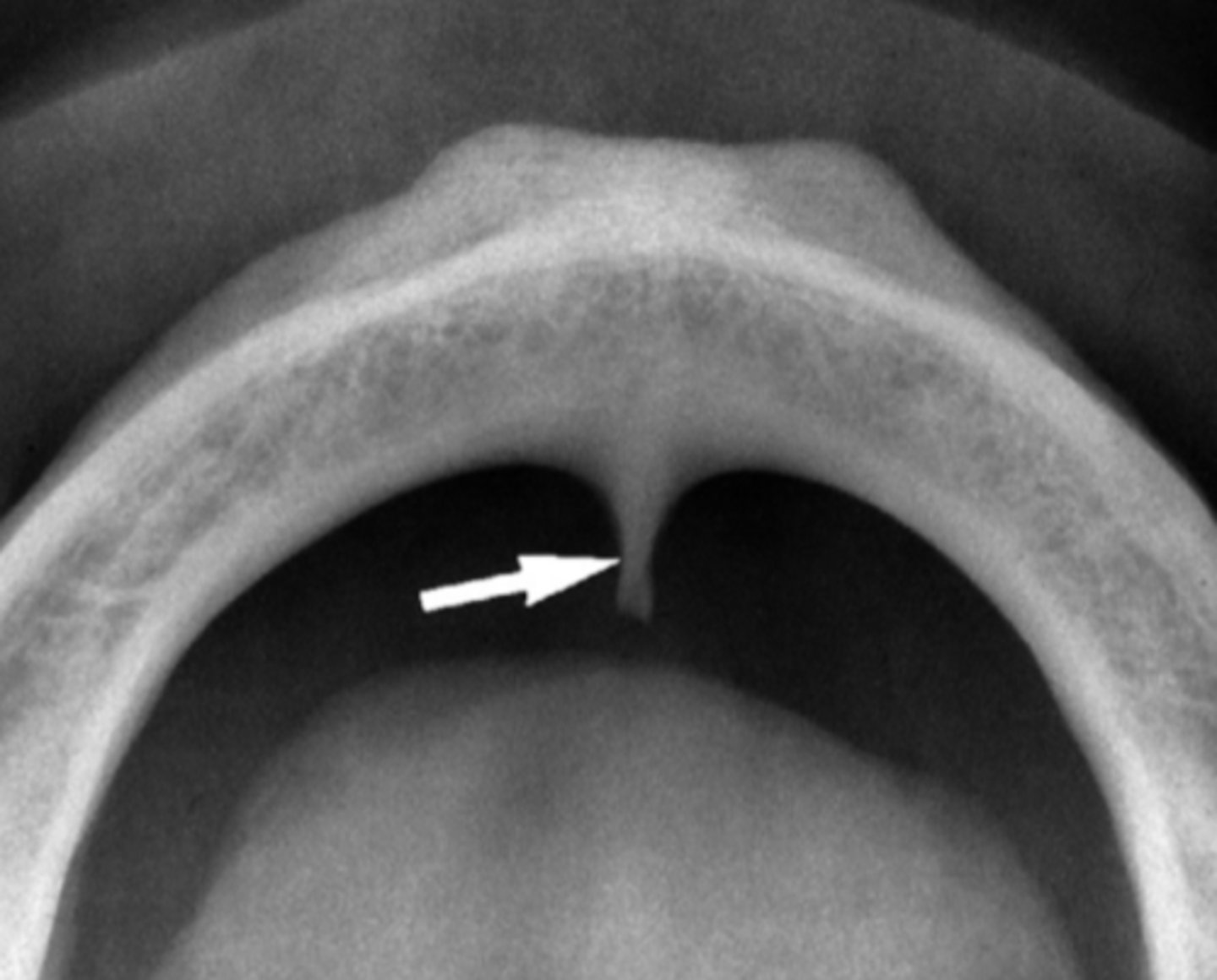 <p>Identify the structure</p>