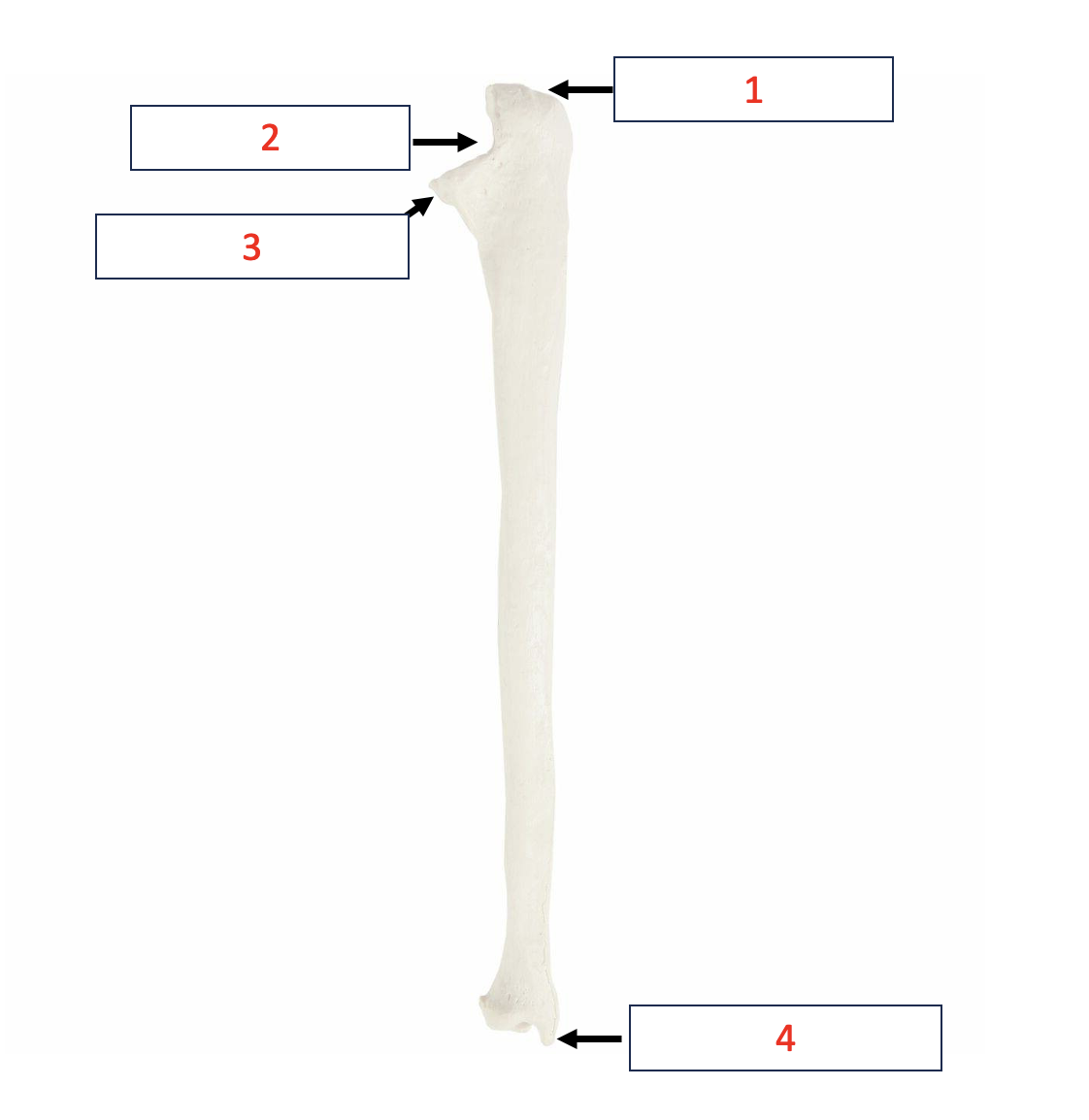 <p>Posterior Ulna - trochlear notch&nbsp;</p>