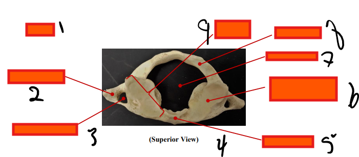 <p>superior</p>