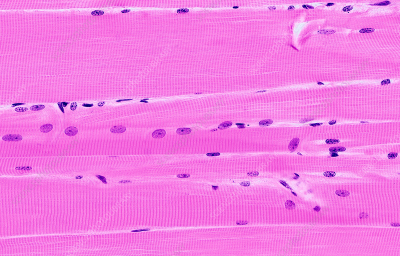 <p>Mostly attached to bones, striated, and voluntary.</p>