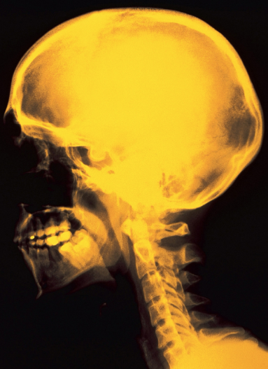<p>Radiography (X-rays)</p>