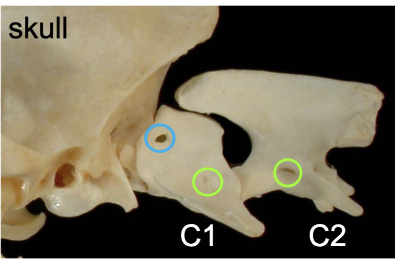 <p>medial → lateral direction     (blue) </p><p>passageways for 1st cervical spinal nn.</p>