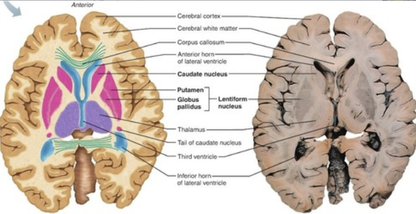 <p>putamen and globus pallidus</p>