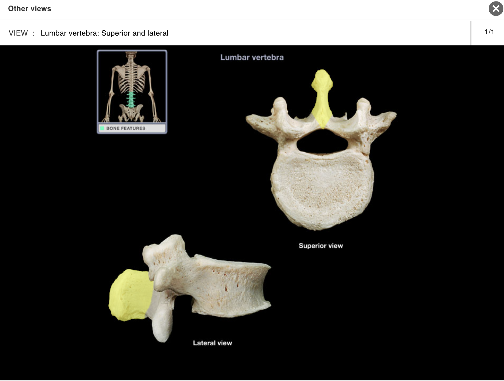 <p>Location:</p><p class="p1">• Vertebrae (posterior aspect)</p><p class="p1">Description:</p><ul><li><p>﻿﻿Unpaired, posterior projection from midline of vertebral arch</p></li><li><p>﻿﻿Has characteristic thick, blunt form</p></li></ul><p class="p1">Comment:</p><ul><li><p>﻿﻿Spinous process present on all vertebrae except the atlas (C1 vertebra) and coccygeal vertebrae</p></li><li><p>﻿﻿Provides attachment for muscles and ligaments</p></li></ul><p></p>
