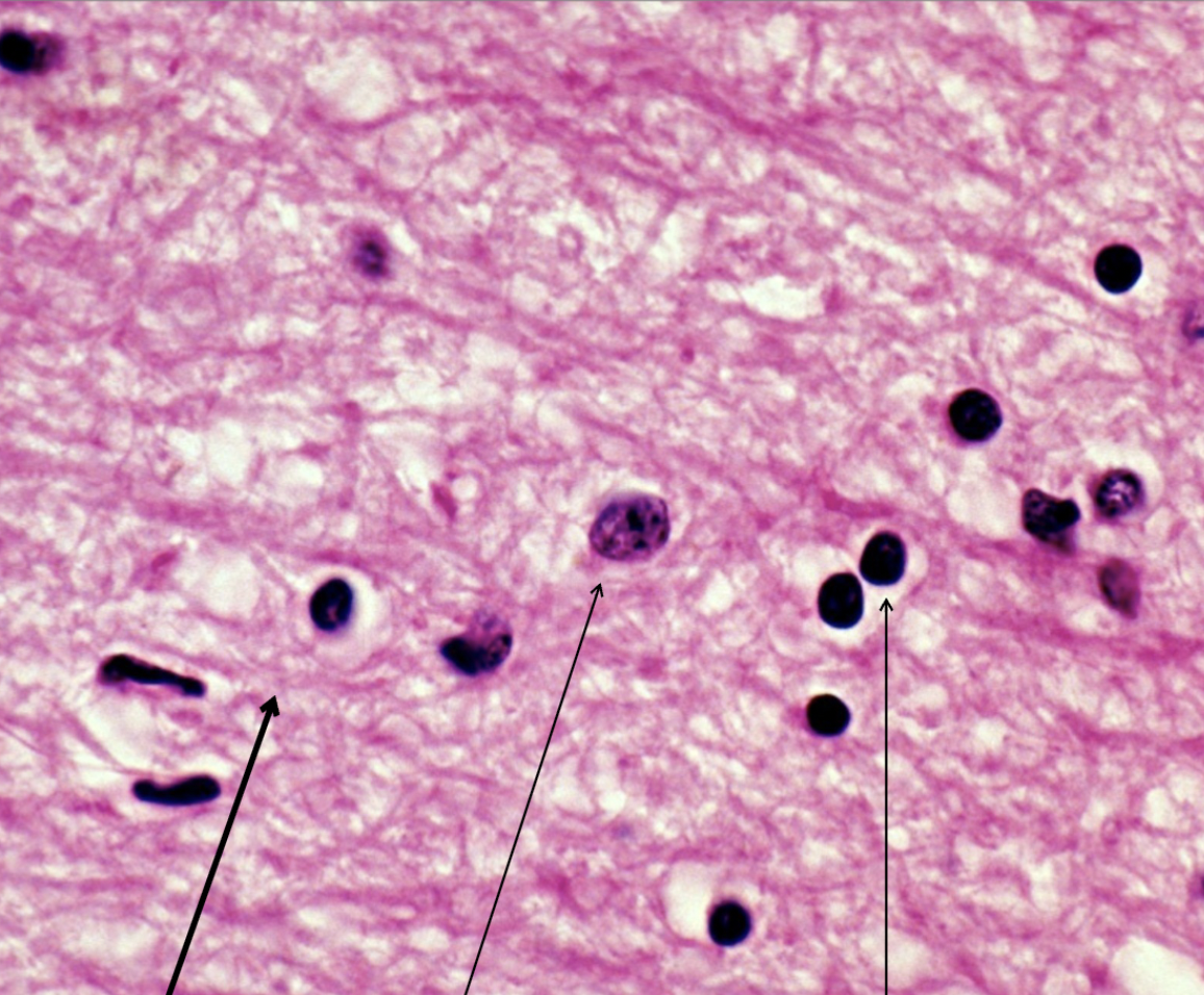 <p>middle</p>