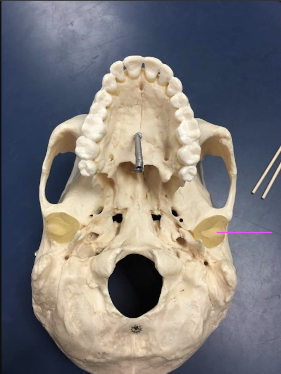 <p>What bone marking is this?</p>