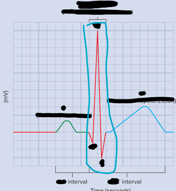 <p>QRS complex</p><ul><li><p>Ventricular depolarization</p></li></ul><p></p>