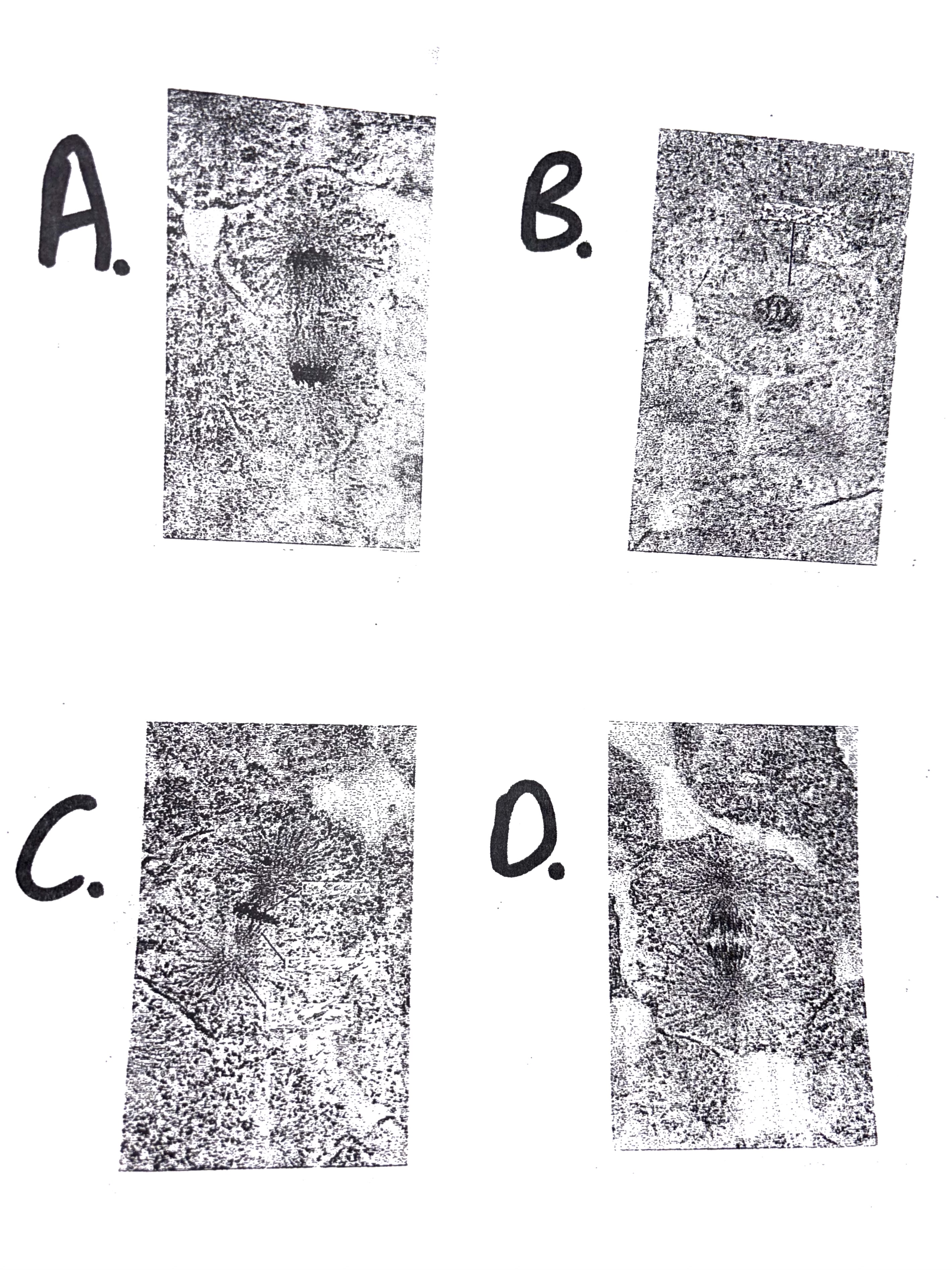 <p>Identify the specific stage of mitosis as shown in the attached diagram.&nbsp;</p>