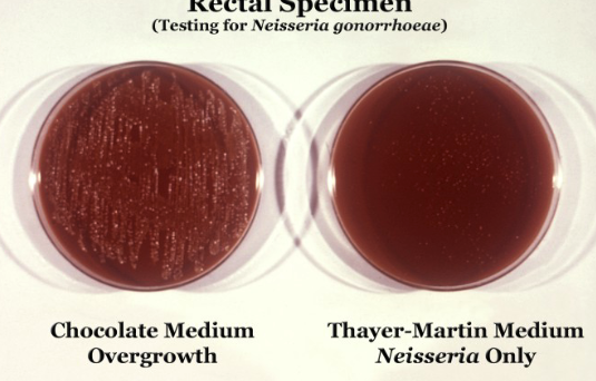 <p>Growth media that prevent the growth of some organisms.</p>