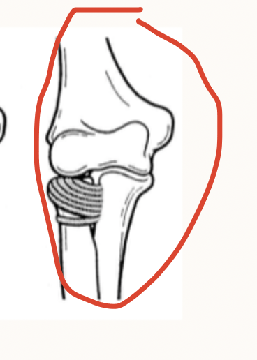 <p>Patho for nursemaids elbow - most common in 1-4 y/os</p>