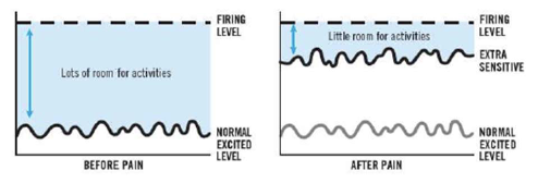 <ul><li><p>an extra sensitive alarm system can impact your life considerably </p></li><li><p>in the days before pain, you had lots of room for movement and activities without causing pain </p></li><li><p>since you developed pain, it takes far less activity or movement before you experience pain </p></li></ul><p></p>