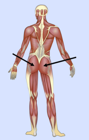<p>What major muscle is this?</p>