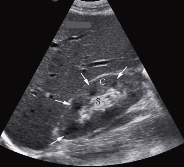 <p>Is this the right or left kidney? </p>
