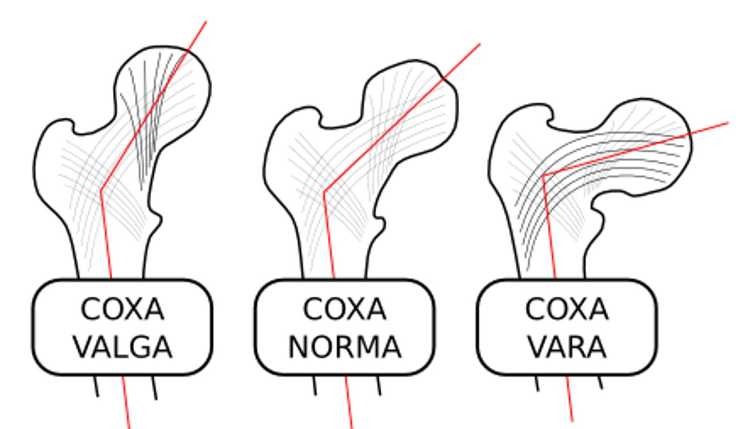 <p>hông = hip/hip joint</p>