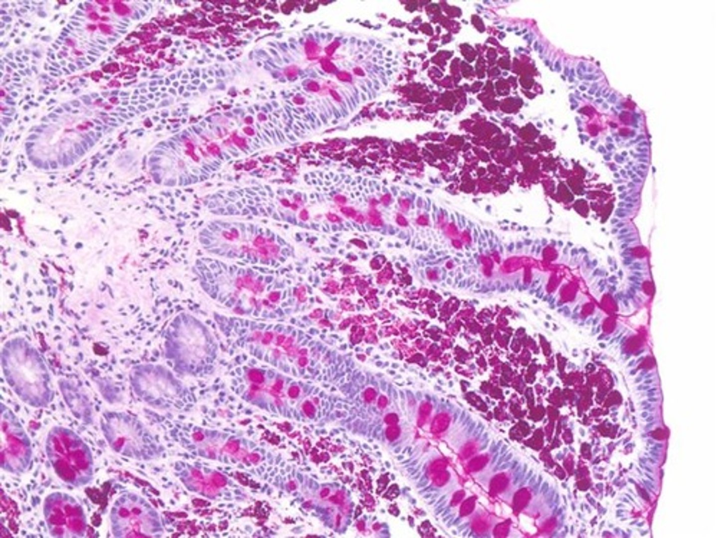 <p>Stains glycogen (PASs the sugar)</p><p>Dx of Whipples dx (tropheryma whipplei)</p>