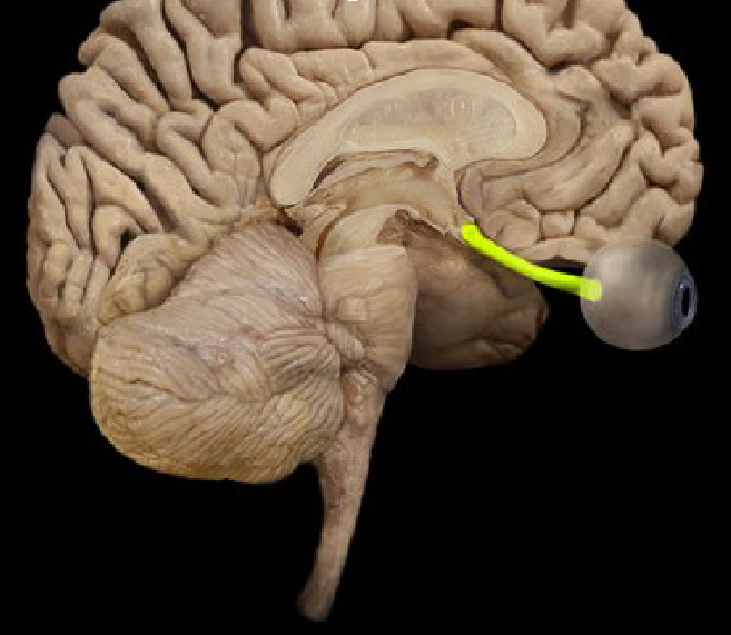 term image