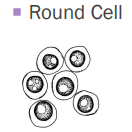 <p>Round cell tumors</p>