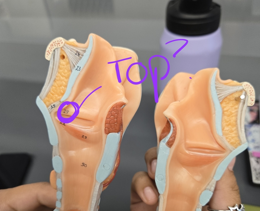 <p>Larynx, Trachea, and Bronchi model: What structure is this?</p>