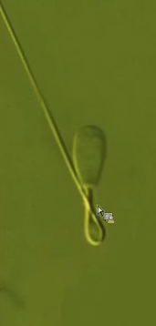 <p>What is an indicator of sperm in the corpus epididymis?</p>