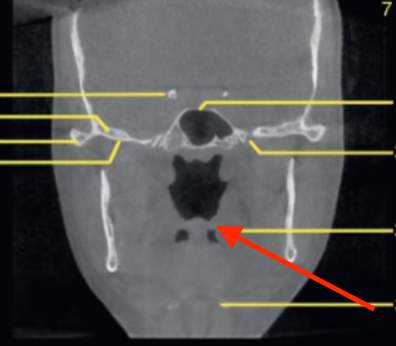 <p>identify the structure </p>