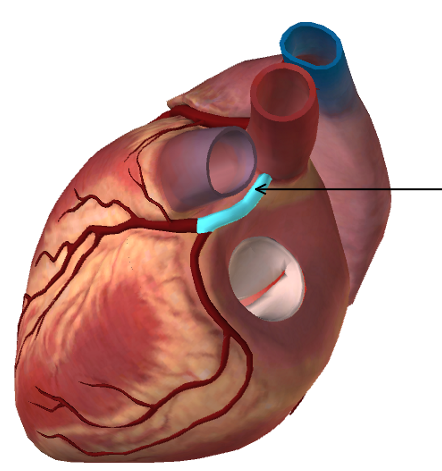 <p><span>Name the vessel in the figure below: (highlighted in blue, also indicated by the arrow)</span></p>