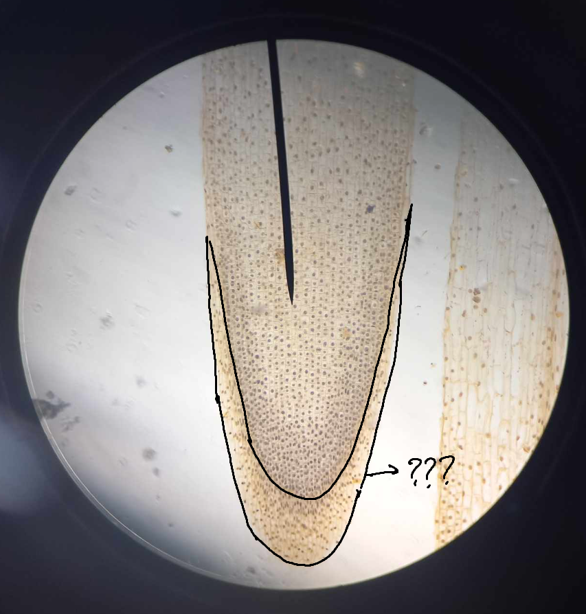 <p><span>part of RAM; protective tissue located at the tip of every root</span></p>