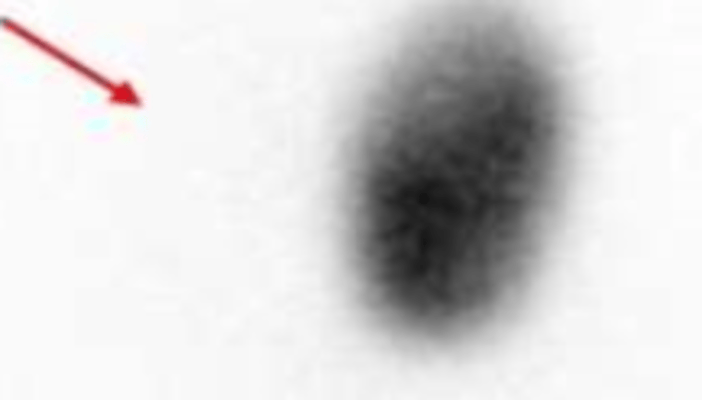 <p>autonomous nodule</p>