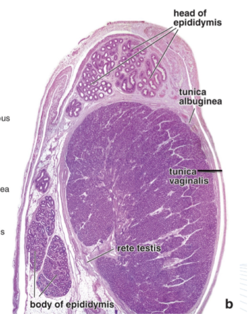 <p>Blått: Testis. </p><p>Ljusgrönt: Epididymis huvud.</p><p>Mörkgrönt: Epididymis svans. </p><p>Höger kant: Vas deferens.</p><p>Längst upp: Kärlplexat.</p>