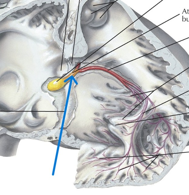 <p>Which part of the conduction system is this?</p>