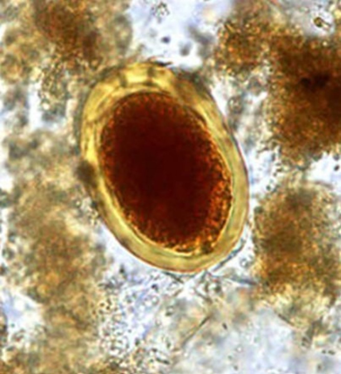 <p>Identify the parasite</p>