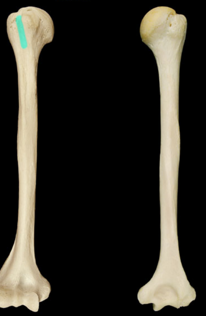 <p>what part of the humerus is this </p>