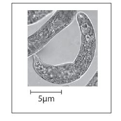 <p>What is the magnification of the image?</p>