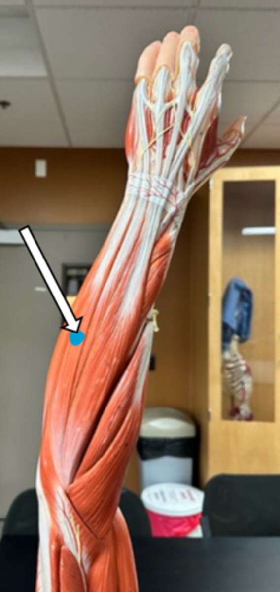 <p>extensor carpi ulnaris (function)</p>