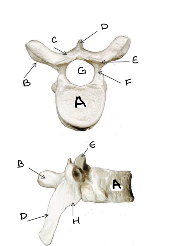 <p>Type of Bone: Thoracic Vertebrae</p><p>What is G ?</p>