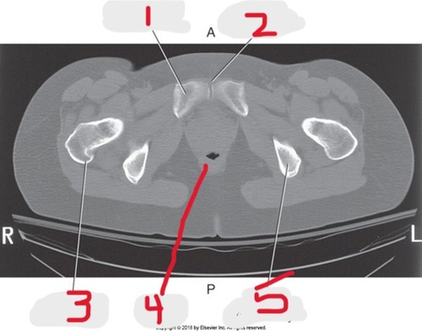 <p>Name all numbered structures</p>